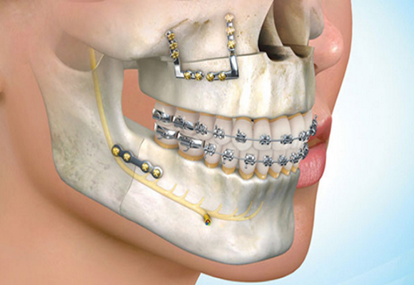 Oral and Maxillofacial Surgery